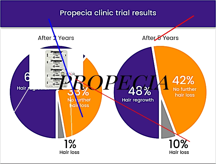 Propecia 1mg prix